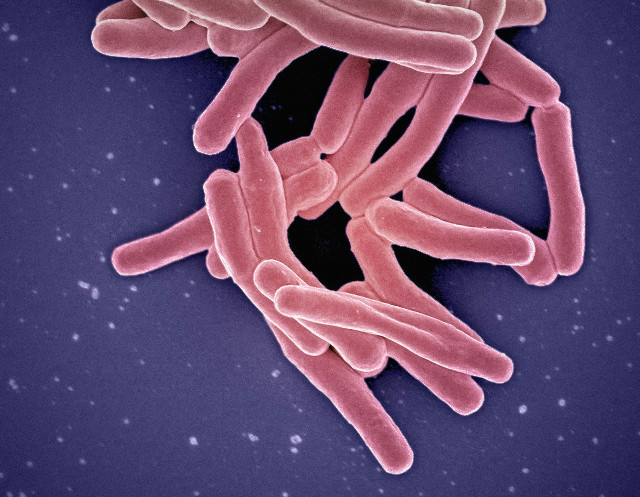 Scanning electron micrograph of Mycobacterium tuberculosis particles (colorised pink), the bacterium which causes TB. Photo by <a href="https://unsplash.com/@niaid?utm_content=creditCopyText&utm_medium=referral&utm_source=unsplash">National Institute of Allergy and Infectious Diseases</a>